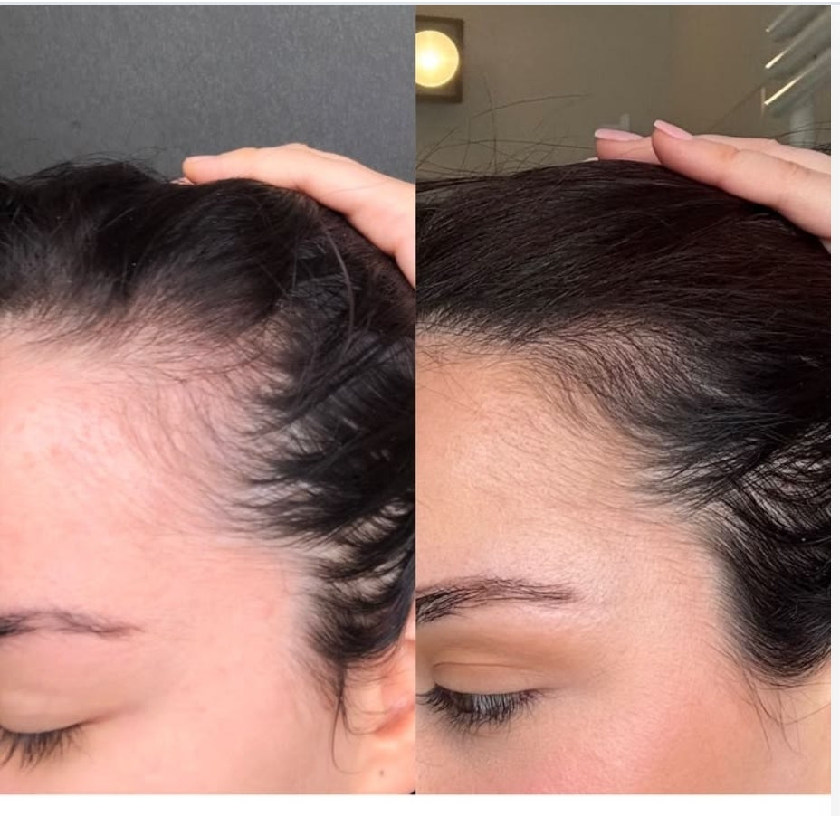 Huile fortifiante et pousse des cheveux