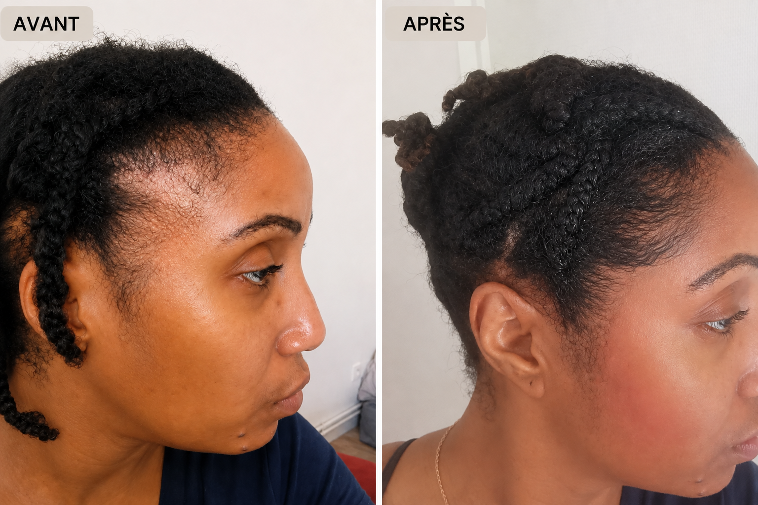 Huile fortifiante et pousse des cheveux